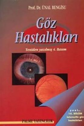 Resim Göz Hastalıkları