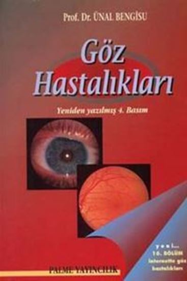 resm Göz Hastalıkları