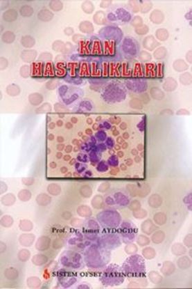 Resim Kan Hastalıkları
