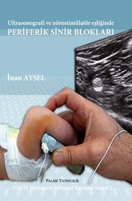 Resim Ultrasonografi ve nörostimülatör eşliğinde PERİFERİK SİNİR BLOKLARI