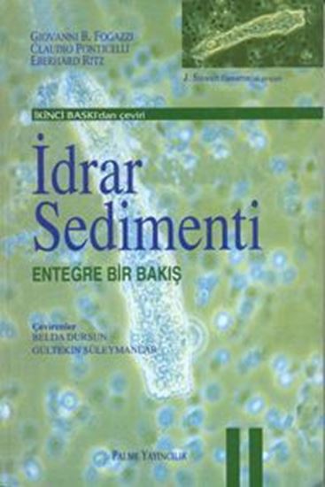 resm İdrar Sedimenti Entegre Bir Bakış