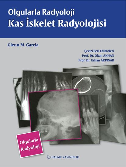 resm OLGULARLA RADYOLOJİ KAS İSKELET RADYOLOJİSİ