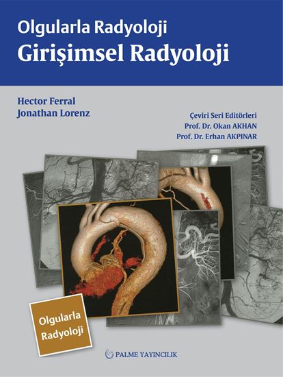 resm OLGULARLA RADYOLOJİ GİRİŞİMSEL RADYOLOJİ