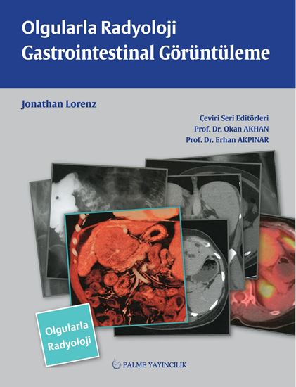 resm OLGULARLA RADYOLOJİ GASTROİNTESTİNAL GÖRÜNTÜLEME