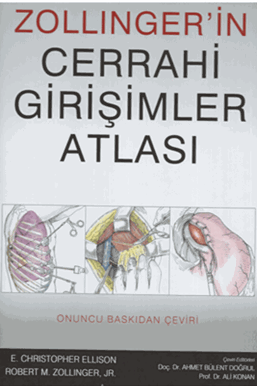 resm Zollinger'in Cerrahi Girişimler Atlası