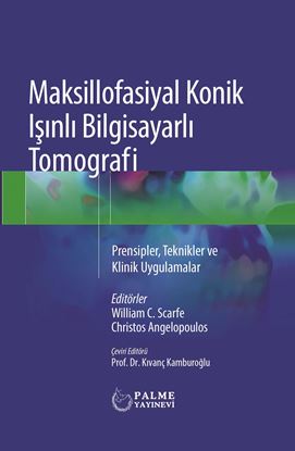Resim MAKSİLLOFASİYAL KONİK IŞINLI BİLGİSAYARLI TOMOGRAFİ